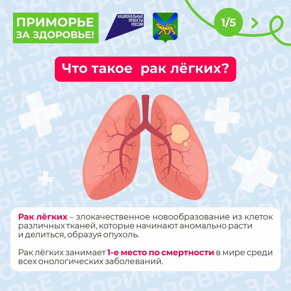 Неделя профилактики рака легкого 3-9 ноября 2025